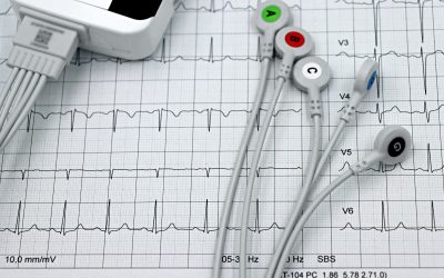 Valutazione HRV: cos’è, a cosa serve e perché è importante